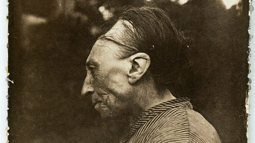 Head shaping, or "bandeau,"